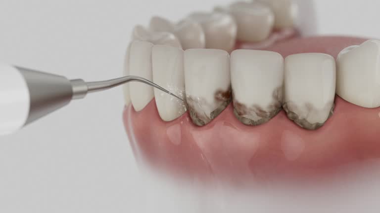 Extra Smile Family Dentistry dental team at work